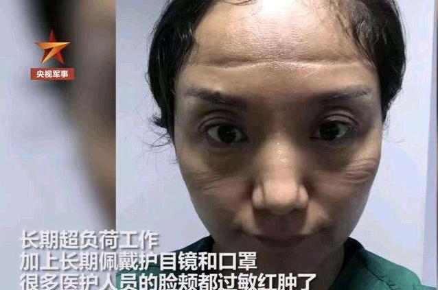 “當(dāng)醫(yī)生摘下口罩的瞬間”，戰(zhàn)“疫”中的她們最美！