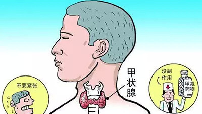 甲狀腺長結(jié)節(jié) 難道離癌不遠(yuǎn)了？！
