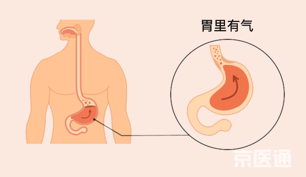 宣醫(yī)科普|突然打嗝又止不??？醫(yī)生給出了3種科學(xué)方法！