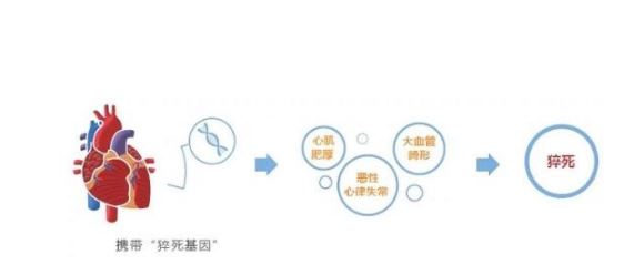 心源性猝死?重要致病基因被發(fā)現(xiàn)
