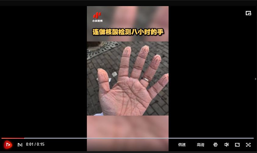 連做核酸檢測八小時的手