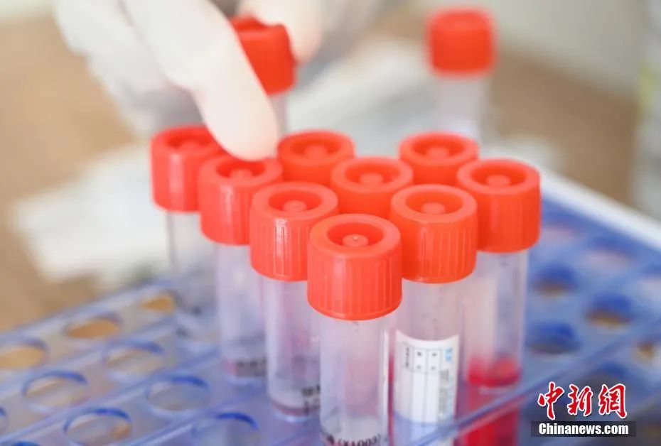 核酸報告“假陽性”？核酸檢測機構也得檢測