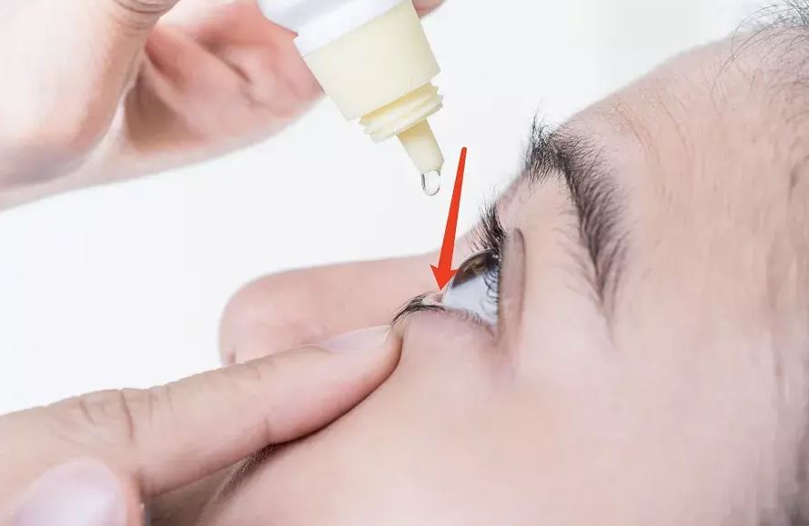 滴眼藥后眨眼還是閉眼？很多人都做錯了！