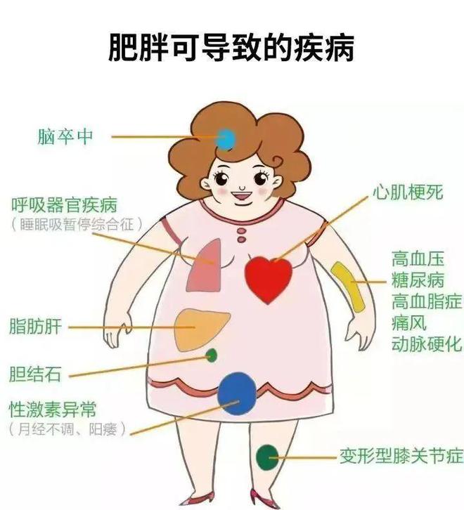《肥胖癥診療指南（2024年版）》發(fā)布